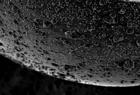 d15_tooth03