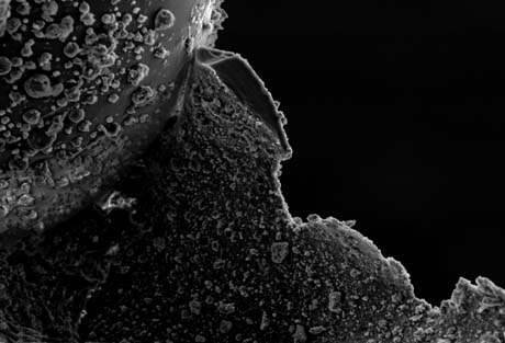 d15_tooth10